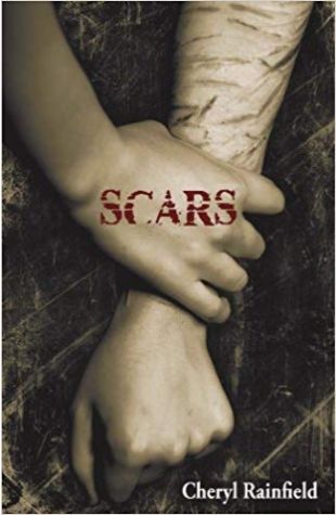 Scars