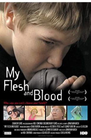 My Flesh and Blood Jonathan Karsh